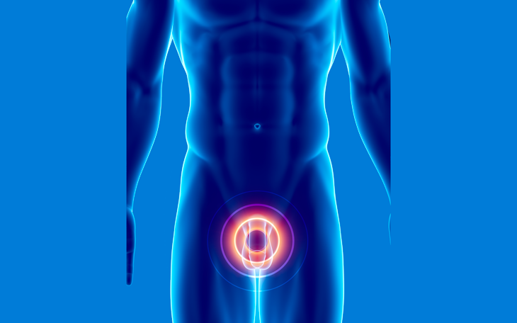 10 mitos sobre o câncer de próstata